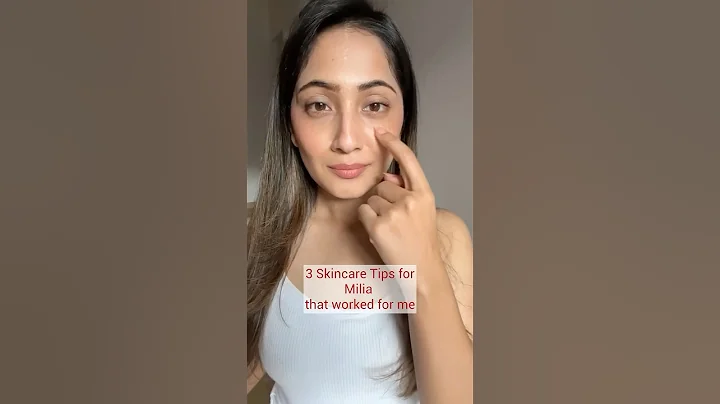 3 Easy Skincare Tips for Milia That Worked For Me