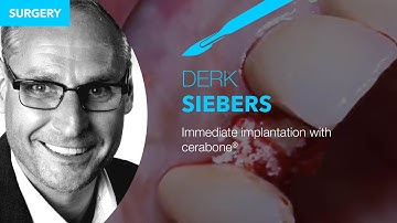 Immediate implantation with cerabone®