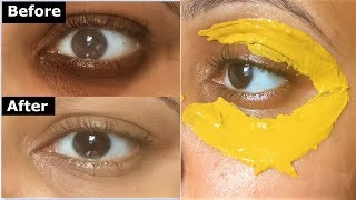 Turmeric Eye mask to Remove DARK CIRCLES, Under Eye wrinkles & under eye bags