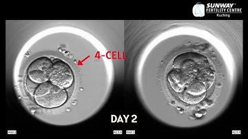 IVF time-lapse imaging | Sunway Fertility Centre