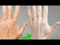 How  To Make Your Hands Look 5 Years Younger! Wrinkle Free Smooth Hands |Dr. Vivek Joshi