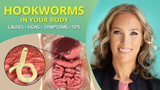 Hookworms | Causes, Signs, Symptoms, & Tips #parasites | Dr. J9 Live