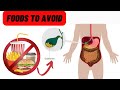 Foods to Avoid with Gallstones | Gallstones Diet