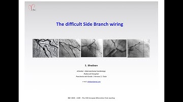 Difficult Side Branch Wiring - Prof Imad Sheiban