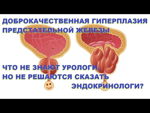 ДГПЖ: что не знают урологи, но не решаются предложить эндокринологи?