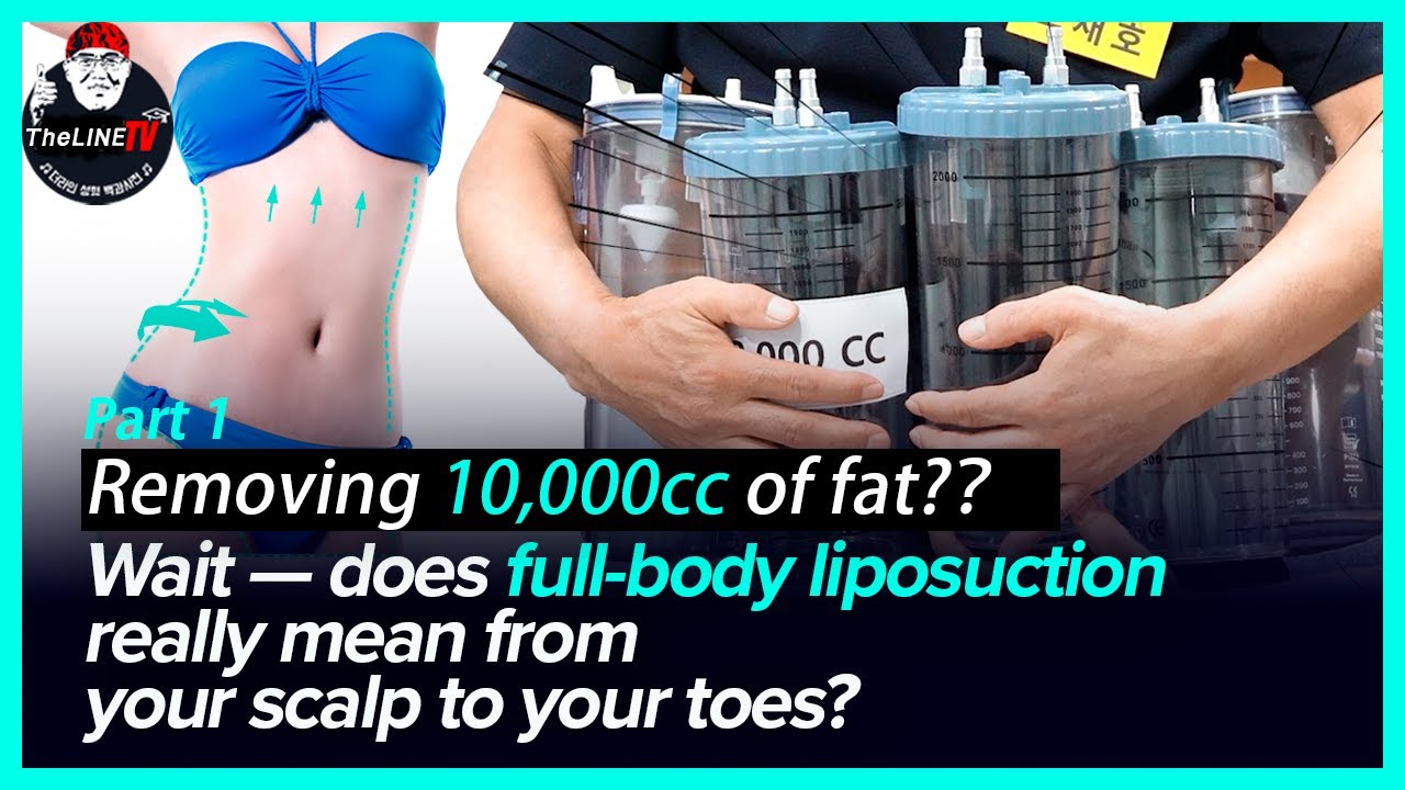 Which areas are included when we talk about full-body liposuction? 
