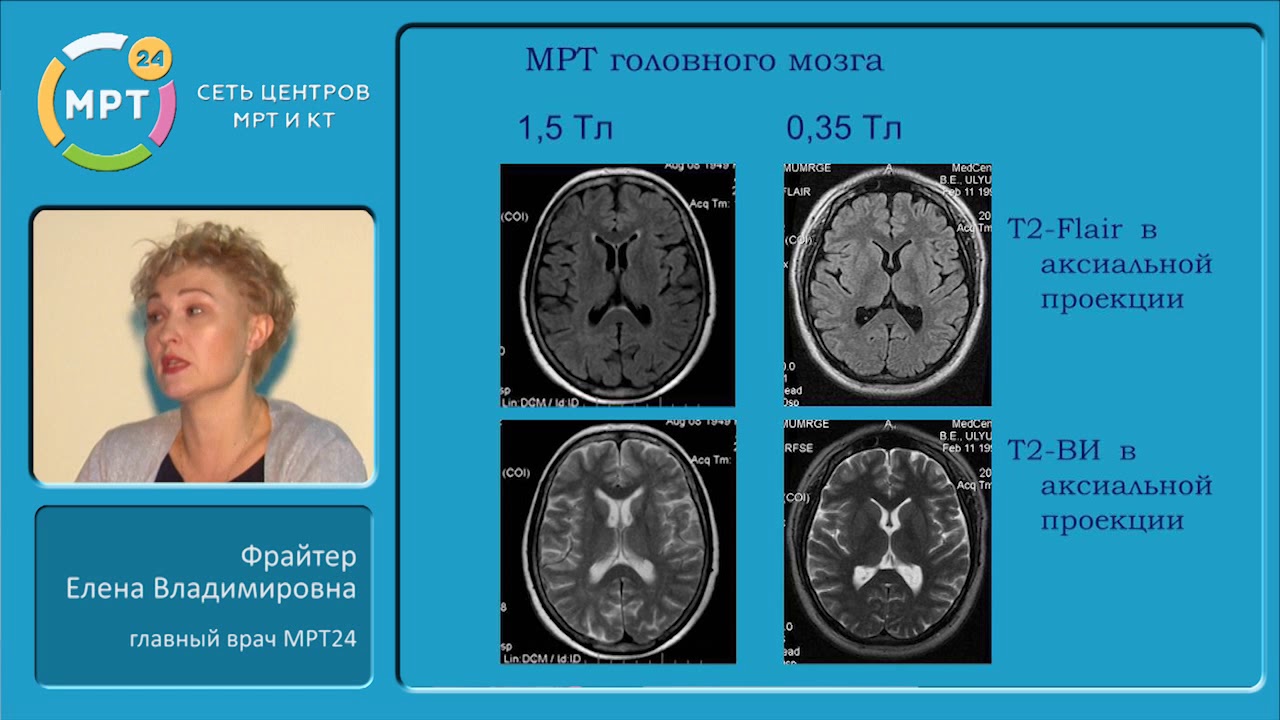 МРТ-иссследования. Показания. Противопоказания. Роль контрастирования