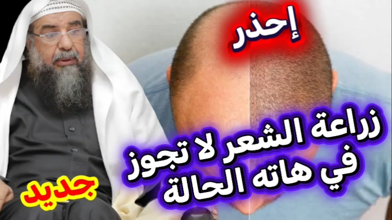 لا يجوز زراعة الشعر // جديد الشيخ سليمان الرحيلي حفظه الله