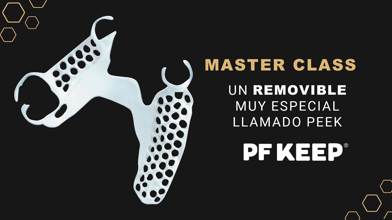 Master Class  PF KEEP® Un removible muy especial llamado Peek