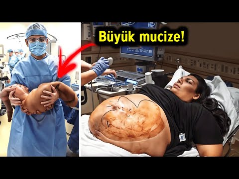 Amerikalı Bir Doktor, Müslüman Bir Kadının Doğumuna Girdi, Bebek Doğduğunda Büyük Bir Mucize Oldu!