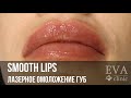 SMOOTH LIPS: КРАСИВЫЕ ГУБЫ БЕЗ ИНЪЕКЦИЙ