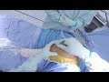 Total Knee Replacement - Surgical Technique