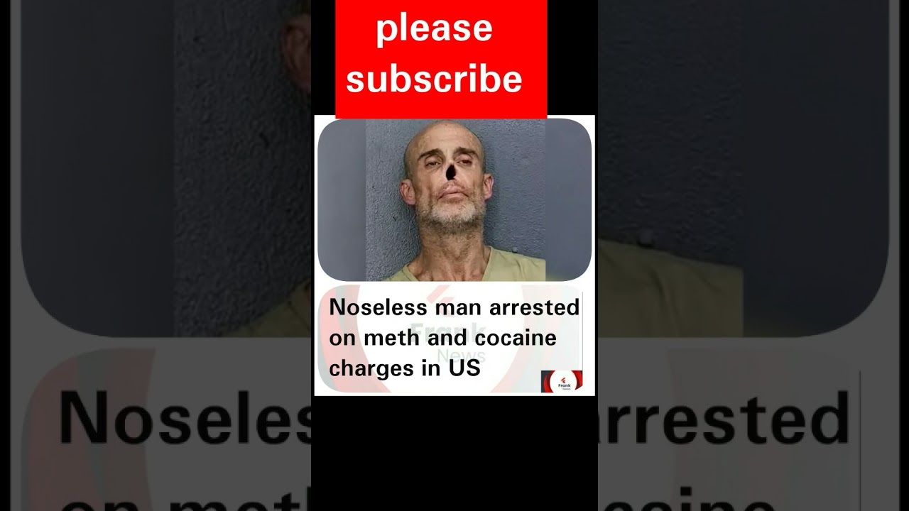 Noseless man arrested on meth and coc@ine charges