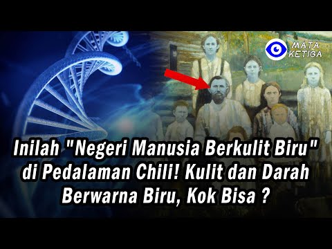 Inilah "Negeri Manusia Berkulit Biru" di Pedalaman Chili! Kulit dan Darah Berwarna Biru, Kok Bisa ?