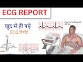 Ecg report kaise dekhe || ecg report kaise karte he 