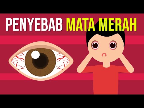 Video: Apa yang menyebabkan mata merah dalam gambar