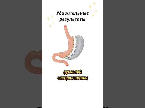 КАК ПОХУДЕТЬ НАВСЕГДА?