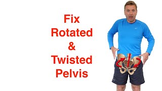 Best Rotated Pelvis Correction Exercises