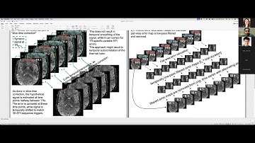 Renzo Huber: LN2 FRISGO- A software solution for artifact mitigation in fast high resolution fMRI