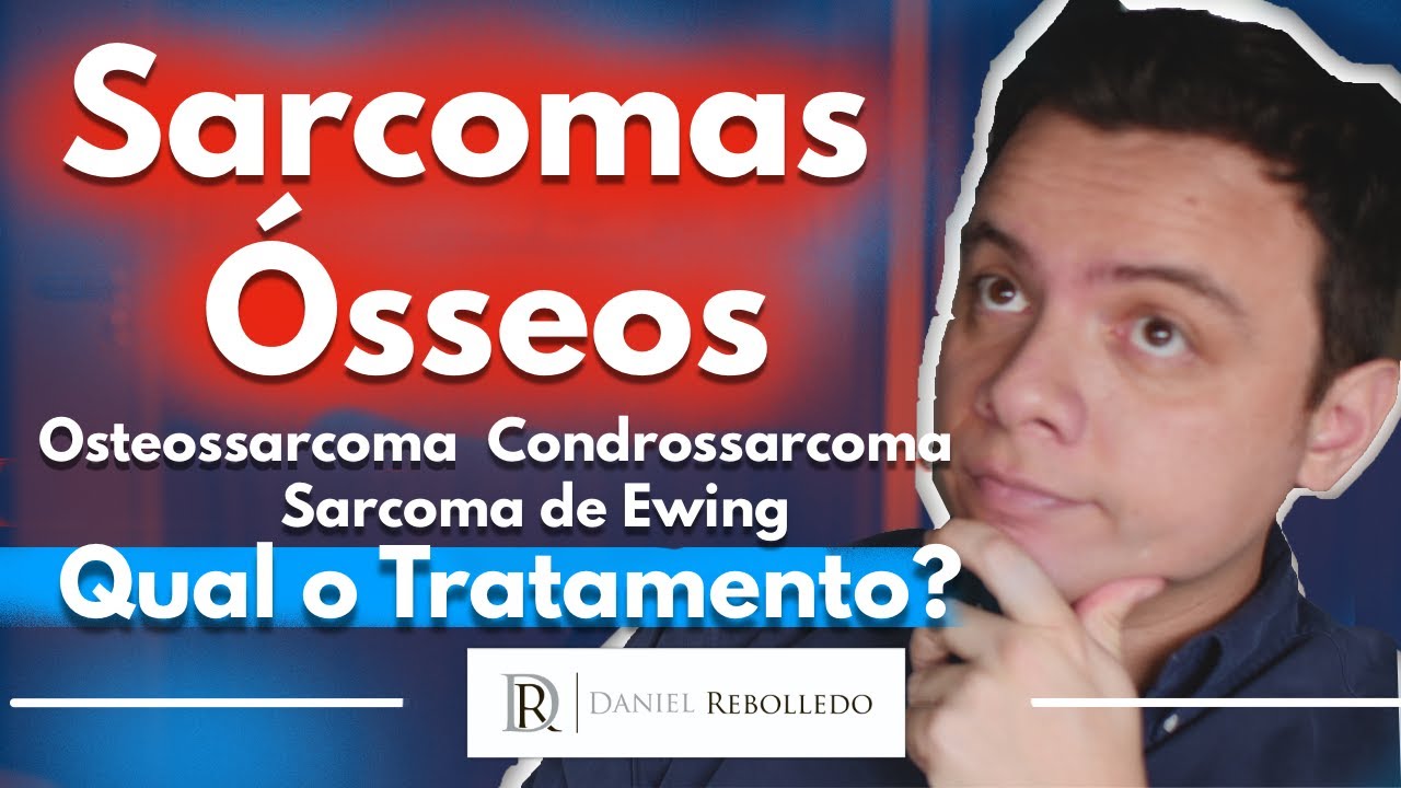 Sarcomas ósseos. Qual o Tratamento? (Osteossarcoma/ Condrossarcoma e Sarcoma de Ewing)