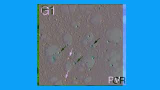 F6EF1E0DD5647076C2E811A8FC1711#1