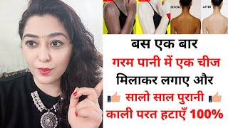 2 चम्मच गर्म पानी से काली गर्दन,घुटने,चेहरा की काली परत निकालें no dark colour only fair skin 100%?