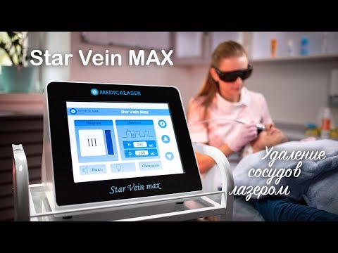 Лазер для удаления сосудов Star Vein Max! Прекрасное сочетание качества и функциональности!