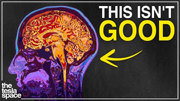 Neuralink Isn