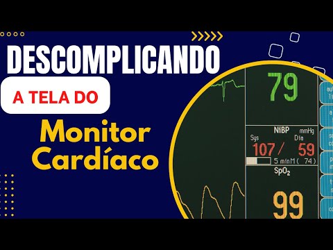 Interpretando a Tela do Monitor Cardíaco