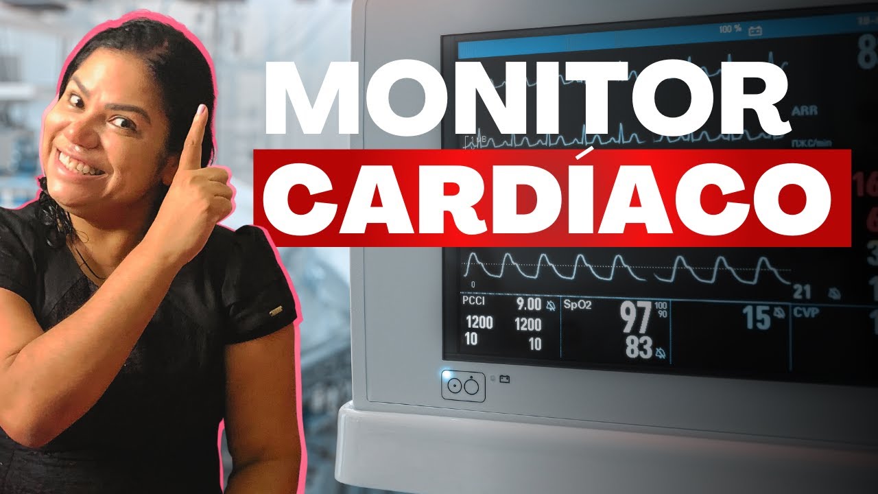 Interpretando a Tela do Monitor Cardíacoenfermagem