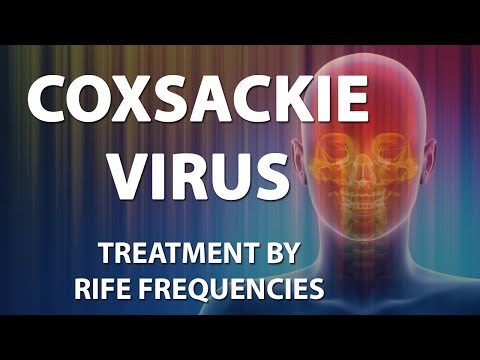 Video: Coxsackie-virus Lapsilla - Oireet, Hoito, Ehkäisy, Seuraukset