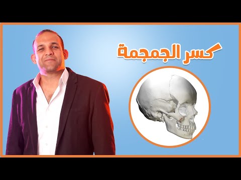 فيديو: هل كسر في الجمجمة؟