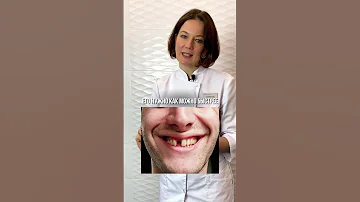 что делать если ВЫБИЛИ ЗУБ?!   #советы #важное #стоматология #зубы