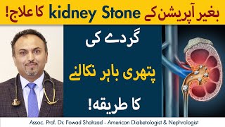 Kidney Stones Ko Kaise Nikala Jae | How To Remove Kidney Stones Without Surgery? screenshot 2