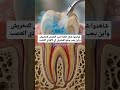 يفضل وضع المخرش على المينا فقط للتقليل من حساسية السن بعد حشوة الضوئية تجميل اكسبلور لايك اشتراك