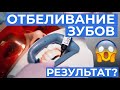 Отбеливание зубов. как это? и какой результат?