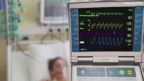 Watchman Procedure at BSW providing an alternative to blood thinners for those with AFib