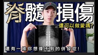 坐輪椅後還可不可以做愛?後遺症?你所不知道的脊髓損傷(Spinal Cord Injury)! |chairman椅人 坐輪椅後還可不可以做愛?後遺症?你所不知道的脊髓損傷(Spinal Cord Injury)! |chairman椅人