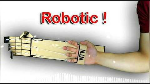 [ You - Alex Skinrido ] NTN - Làm Cánh Tay Robot