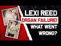 Fatgirlfedup  lexi reed organ failure what went wrong