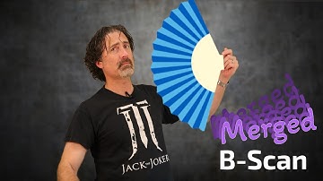 Merged B-Scan