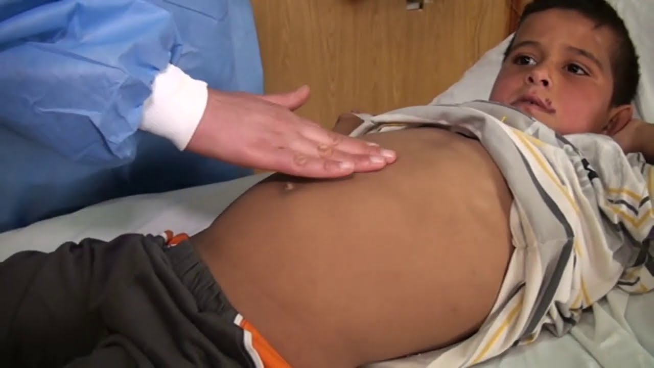 pediatric abdominal examination