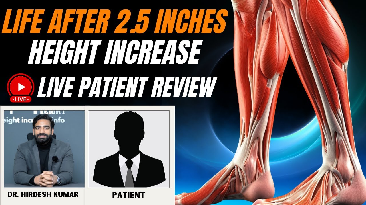 Life after 2.5 inches height increase live patient review | Height Increase Surgery in India