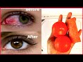 Comment amliorer la vue instantanment en 5 jours avec la recette naturelle vivante de tomates