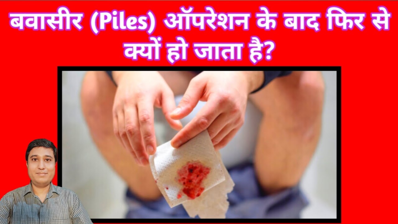 Pils Problem Piles Problem | Piles akir thik kyu nahi hota hai - YouTube