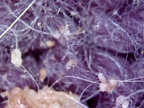microscopio per vedere acari