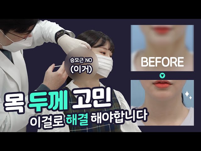(ENG) 두꺼운 목 얇아지는 법, 목살이 문제가 아니였다구요? How to get thinner neck line, It wasn't about the fat?