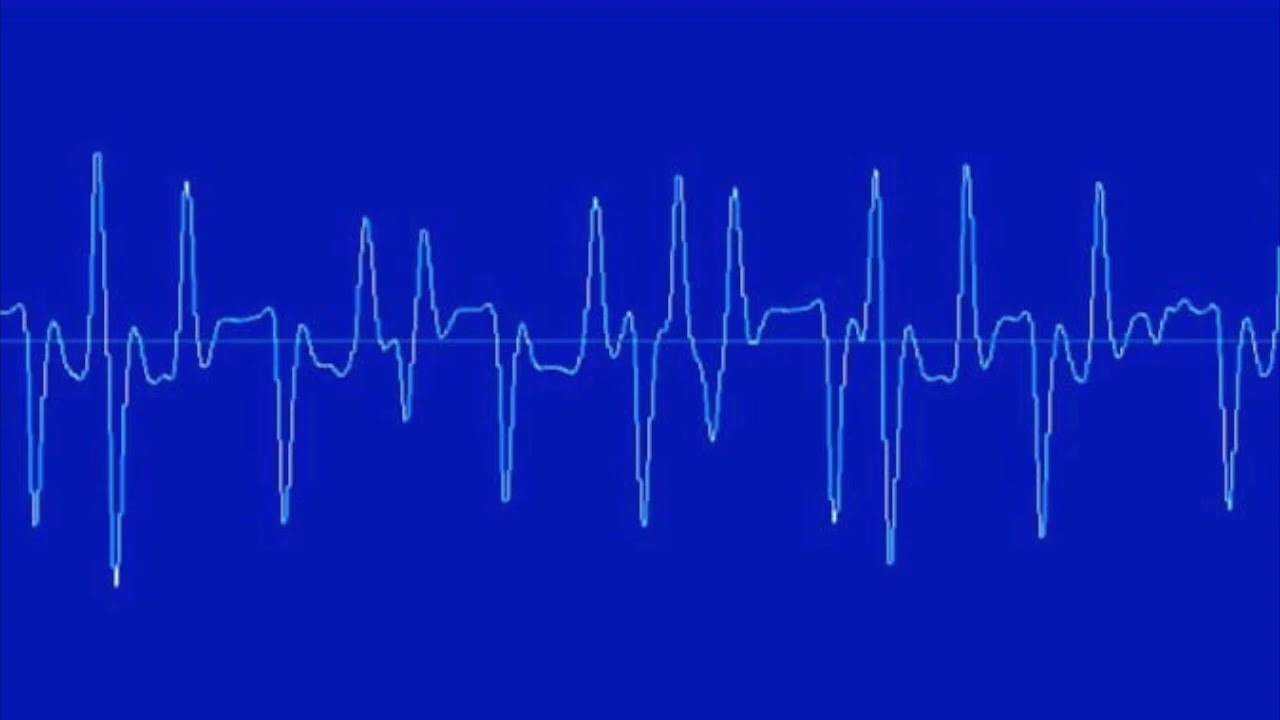 Mosky Classic AC-30  with no FX, just gain.