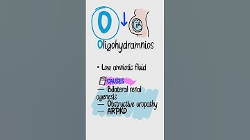 POTTER Sequence Explained in 60s | Oligohydramnios, Renal Agenesis & High-Yield USMLE Review