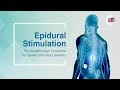 Epidural stimulation the breakthrough procedure for spinal cord injury patients